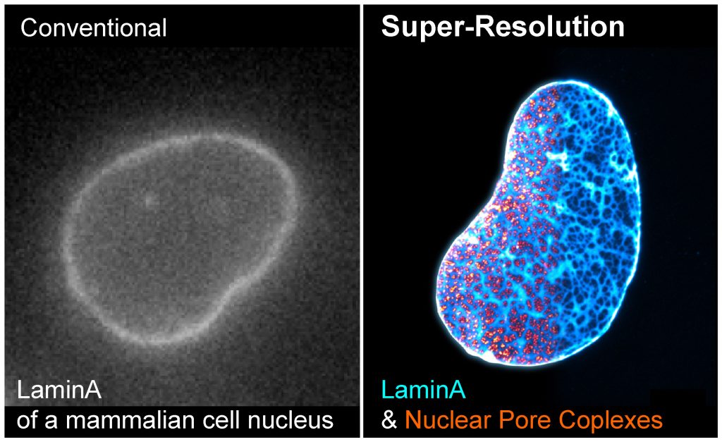 conventional vs super resolution