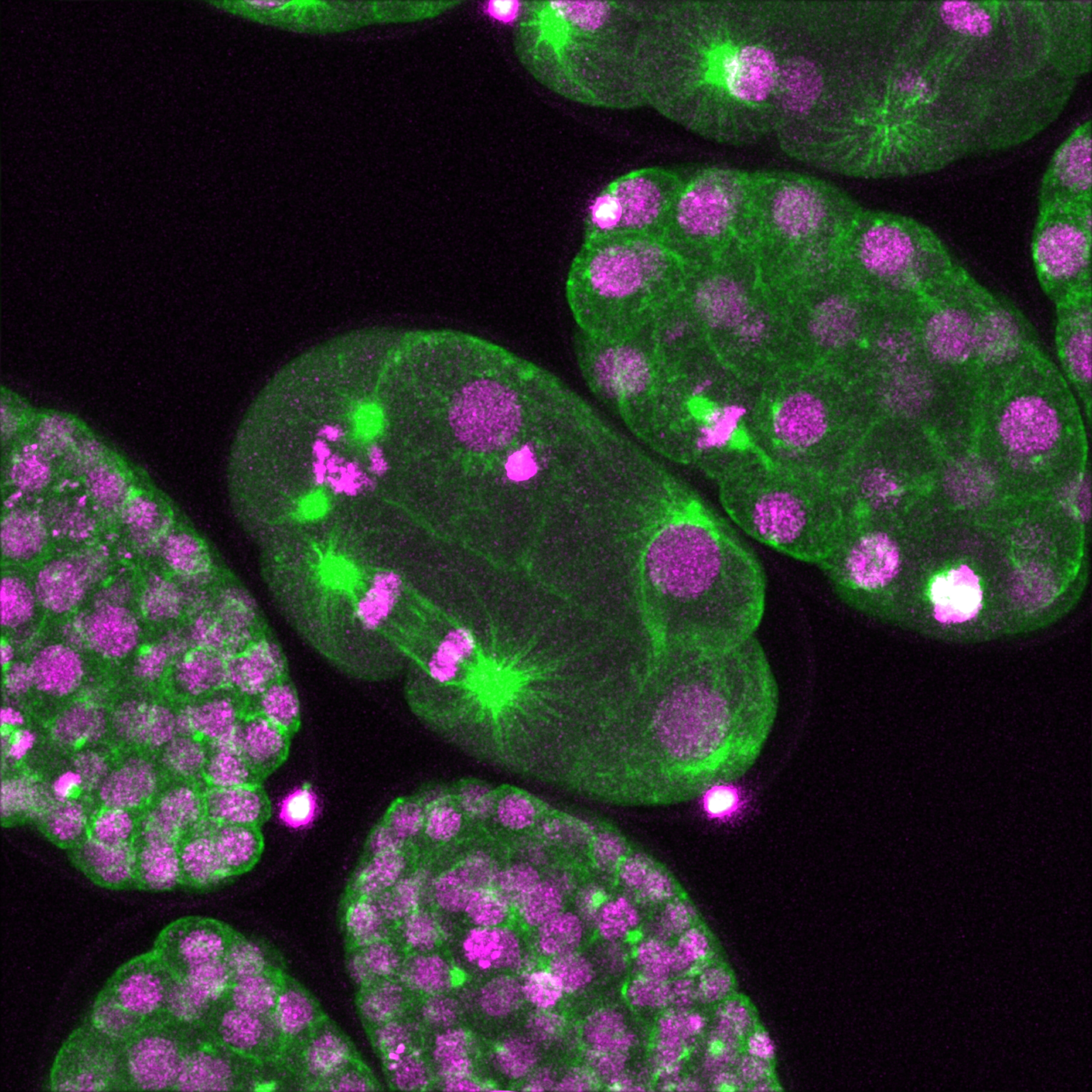 Fluorescence Microscope image of Bovine Pulmonary Artery Endothelial Cells BPAE stained for mitochondria, phalloidin, and nuclei undergoing mitosis